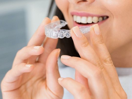 clear aligners (Invisalign braces) - Aple Dentist