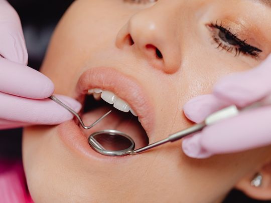 Scaling or Teeth Cleaning in Pune - Aple Dentist